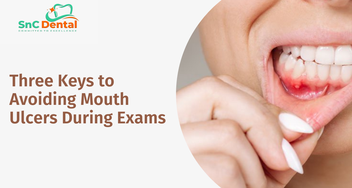 Three Keys to Avoiding Mouth Ulcers During Exams | Dr. Aarti Chaudhary