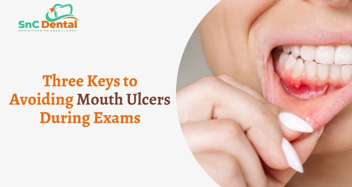 Three Keys to Avoiding Mouth Ulcers During Exams | Dr. Aarti Chaudhary