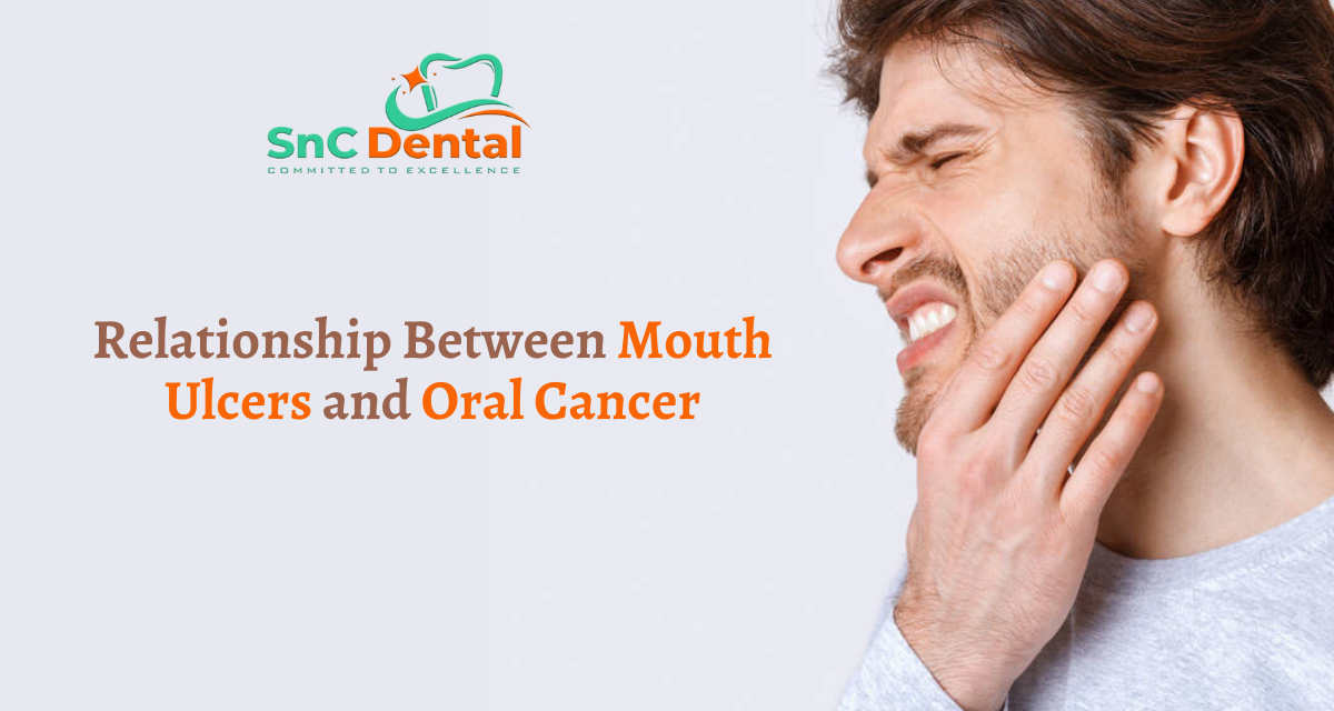 Understanding the Link Between Mouth Ulcers and Oral Cancer | Mouth Ulcer Specialist Doctor