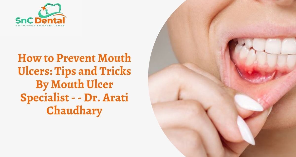 How to Prevent Mouth Ulcers: Tips and Tricks By Mouth Ulcer Specialist – Dr. Arati Chaudhary