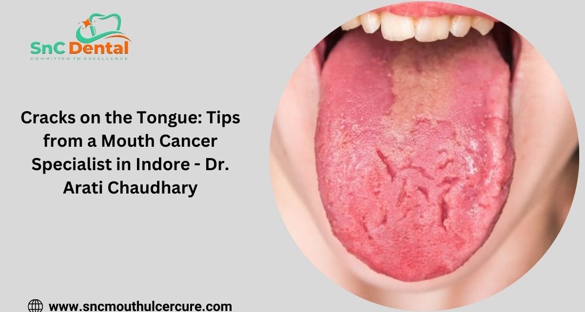 Cracks on the Tongue: Tips from a Mouth Cancer Specialist in Indore – Dr. Arati Chaudhary