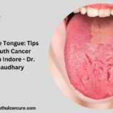 Mouth Cancer Specialist in Indore