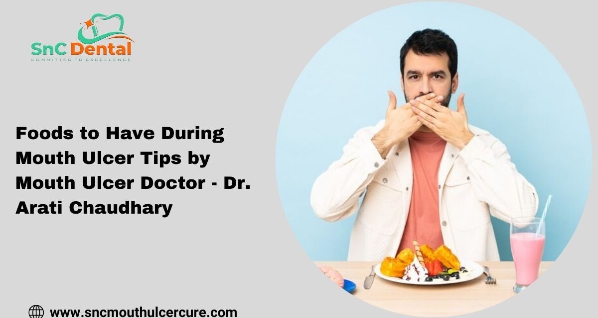 Foods to Have During Mouth Ulcer Tips by Mouth Ulcer Doctor – Dr. Arati Chaudhary