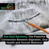 Gut-Oral Harmony: The Powerful Connection Between Digestion, Oral Health and Overall Wellness