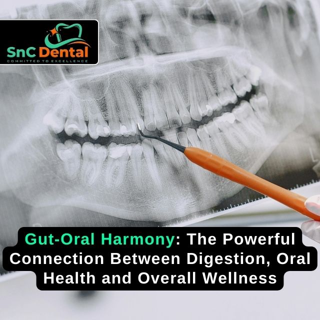 Gut-Oral Harmony: The Powerful Connection Between Digestion, Oral Health and Overall Wellness