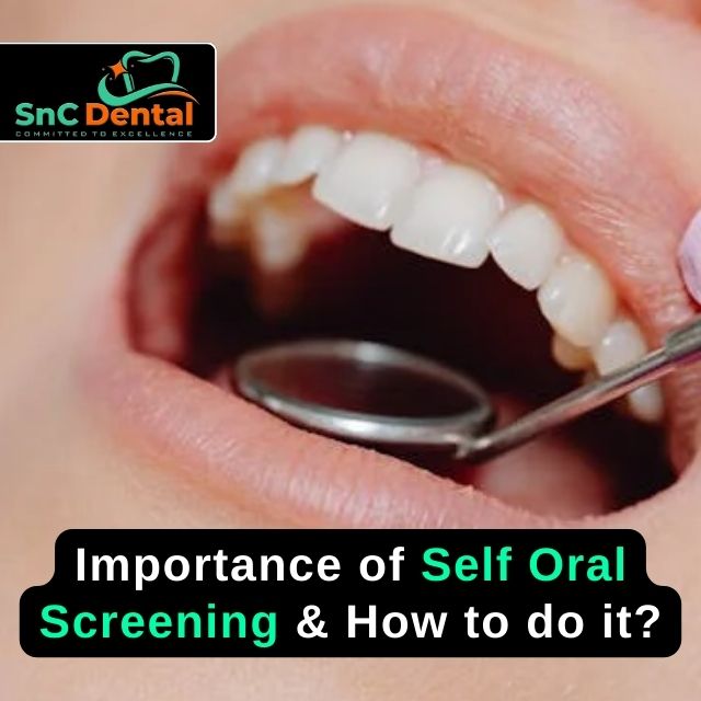 Importance of self Oral Screening & How to do it?