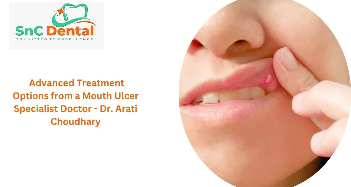 Advanced Treatment Options from a Mouth Ulcer Specialist Doctor – Dr. Arati Choudhary