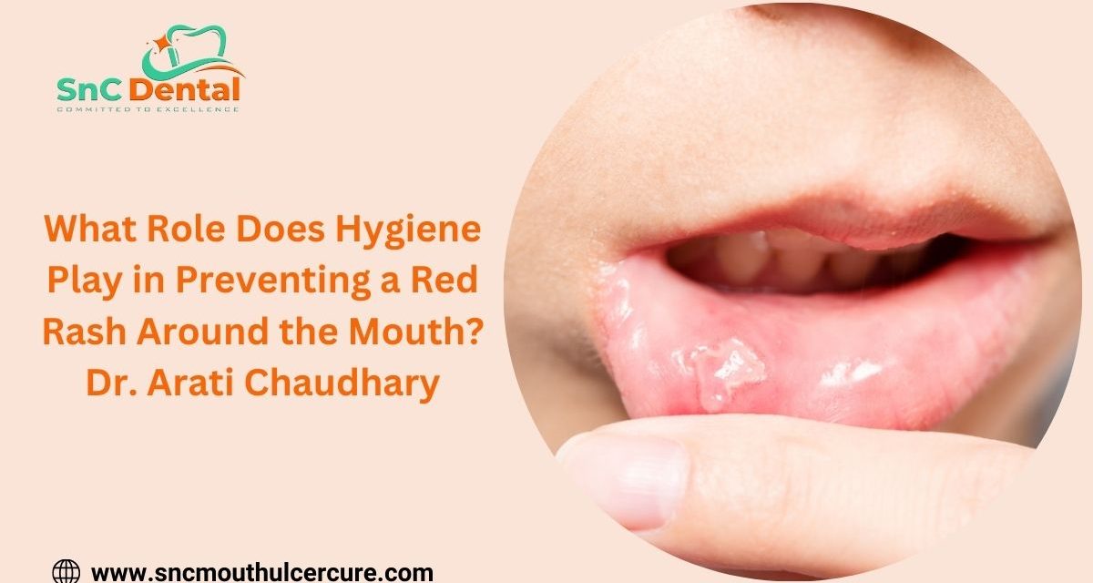 What Role Does Hygiene Play in Preventing a Red Rash Around the Mouth? –  Dr. Arati Chaudhary